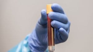 India drops plasma therapy from Covid-19 management guidelines